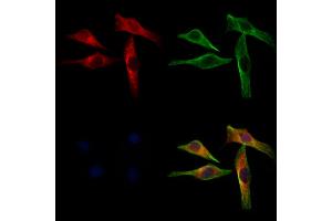 ABIN6262942 and ABIN6272945 staining 3 by IF/ICC. (LDHB Antikörper  (N-Term))