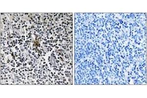 Immunohistochemistry (IHC) image for anti-Ribosomal Protein S3 (RPS3) (AA 171-220) antibody (ABIN2890066) (RPS3 Antikörper  (AA 171-220))