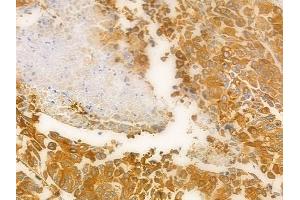 ABIN6262986 and ABIN6278409 at 1/100 staining human normal kidney tissue by IHC-P. (LMAN1 Antikörper  (Internal Region))