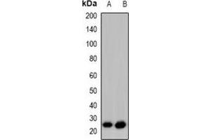 Western blot analysis of GAP43 (pS41) expression in HeLa PMA-treated (A), SHSY5Y (B) whole cell lysates. (GAP43 Antikörper  (N-Term, pSer41))