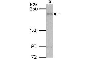 WB Image Sample (30 ug of whole cell lysate) A: H1299 5% SDS PAGE antibody diluted at 1:1000 (ARAP1 Antikörper  (C-Term))