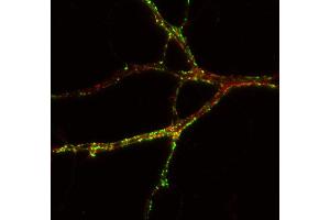 Indirect immunostaining of PFA fixed rat hippocampus neurons with anti-TNiK (dilution 1 : 500; red) and mouse anti-synapsin 1 (cat. (TNIK Antikörper)