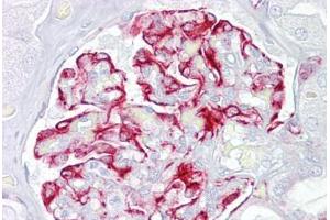 Immunohistochemistry (IHC) image for anti-Activin Receptor Type I (ACRV1) (AA 80-129) antibody (ABIN6748601)
