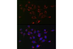 Immunofluorescence (IF) image for anti-serpin Peptidase Inhibitor, Clade B (Ovalbumin), Member 1 (SERPINB1) (AA 100-379) antibody (ABIN6147583)