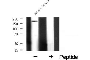 Western blot analysis on mouse brain lysate using ALPK2 Antibody. (ALPK2 Antikörper  (Internal Region))