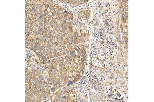 IHC analysis of OAT3/SLC22A8 using anti-OAT3/SLC22A8 antibody (ABIN7599422).