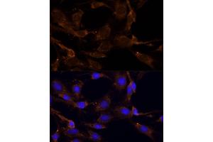 Immunofluorescence analysis of C6 cells using RPL27 Polyclonal Antibody (ABIN6133040, ABIN6147127, ABIN6147128 and ABIN6216885) at dilution of 1:100 (40x lens). (RPL27 Antikörper  (AA 1-136))