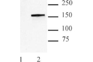 Cas9 antibody (mAb) tested by Western blot. (CRISPR-Cas9 (N-Term) Antikörper)