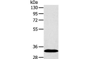 Western Blot analysis of Human fetal liver tissue using SULT2A1 Polyclonal Antibody at dilution of 1:650 (SULT2A1 Antikörper)