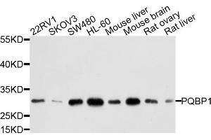 Western blot analysis of extracts of various cell lines, using PQBP1 antibody. (PQBP1 Antikörper)