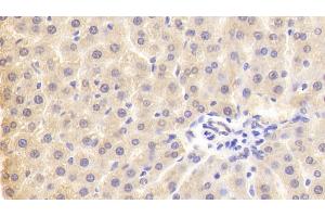Detection of PLA2G3 in Rat Liver Tissue using Polyclonal Antibody to Phospholipase A2, Group III (PLA2G3) (PLA2G3 Antikörper  (AA 20-268))