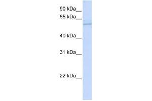 ND5 antibody used at 1 ug/ml to detect target protein.