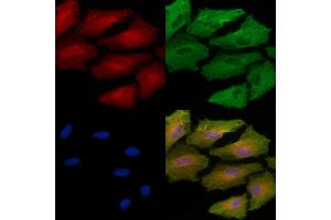 ABIN6261603 and ABIN6272958 staining  cells by IF/ICC. (PDIA4 Antikörper  (Internal Region))