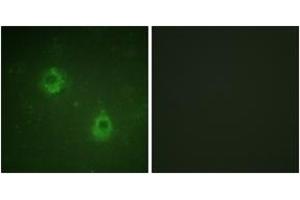 Immunofluorescence analysis of COS7 cells, using APC1 (Phospho-Ser688) Antibody. (APC1 Antikörper  (pSer688))
