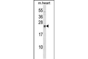 Western blot analysis in mouse heart tissue lysates (35ug/lane). (SOSTDC1 Antikörper  (C-Term))