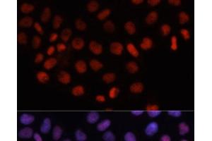 Immunofluorescence analysis of HeLa cells using RCC1 Polyclonal Antibody at dilution of 1:100. (RCC1 Antikörper)