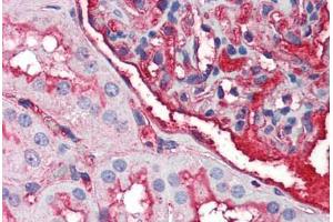Human Kidney (formalin-fixed, paraffin-embedded) stained with EDA2R antibody ABIN214487 at 2. (Ectodysplasin A2 Receptor Antikörper)