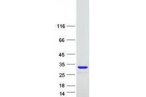 Tetratricopeptide Repeat Domain 36 (TTC36) protein (Myc-DYKDDDDK Tag)