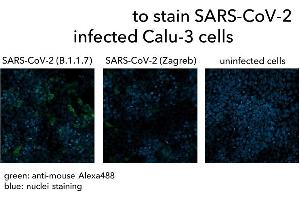 Calu-3 cells were infected with SARS-CoV-2 (B. (Rekombinanter SARS-CoV-2 Spike Antikörper  (AA 319-541))