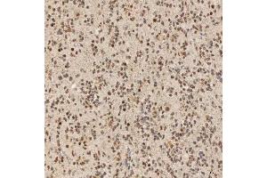 IHC analysis of SNRNP40 using anti-SNRNP40 antibody (ABIN7601719). (SNRNP40 Antikörper  (AA 43-357))