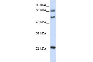 WB Suggested Anti-UNCX Antibody Titration:  0. (UNCX Antikörper  (N-Term))