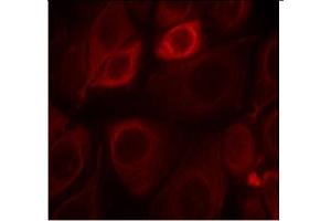 Image no. 1 for anti-Receptor Tyrosine-Protein Kinase ErbB-3 (ERBB3) (pTyr1328) antibody (ABIN319273) (ERBB3 Antikörper  (pTyr1328))