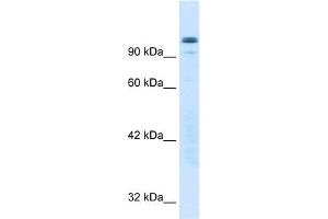 WB Suggested Anti-GTF2I Antibody Titration:  0. (GTF2I Antikörper  (N-Term))