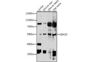 Western blot analysis of extracts of various cell lines, using DDX25 antibody (ABIN7266692) at 1:1000 dilution. (DDX25 Antikörper  (AA 284-483))