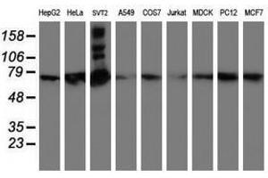 Image no. 2 for anti-SAM Domain and HD Domain 1 (SAMHD1) antibody (ABIN1500798) (SAMHD1 Antikörper)