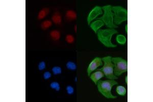 ABIN6264342 and ABIN6277090 staining Hela cells by IF/ICC. (POLR2A/RPB1 Antikörper  (Internal Region))