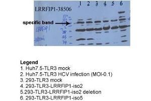 Sample Type: Hepatitis C Virus & 293 TransfectionsPrimary Dilution: 1ug/mL (LRRFIP1 Antikörper  (N-Term))