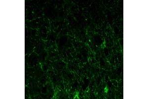 Immunofluorescence analysis of paraffin-embedded lobe of brain tissues using GFAP mouse mAb (green). (GFAP Antikörper)