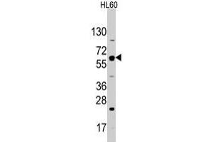Western blot analysis of SLC2A2 polyclonal antibody  in HL-60 cell line lysates (35 ug/lane). (SLC2A2 Antikörper  (N-Term))