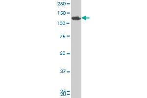 SMARCA5 polyclonal antibody (A01), Lot # 051018JC01 Western Blot analysis of SMARCA5 expression in Y-79 . (SMARCA5 Antikörper  (AA 59-147))