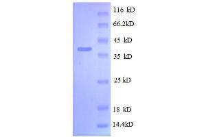 SDS-PAGE (SDS) image for 30S Ribosomal Protein S13 (AA 2-118), (full length) protein (GST tag) (ABIN1046324) (30S Ribosomal Protein S13 (AA 2-118), (full length) protein (GST tag))