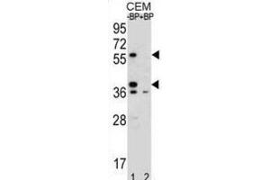 Western Blotting (WB) image for anti-Myeloid Cell Nuclear Differentiation Antigen (MNDA) antibody (ABIN2996101) (MNDA Antikörper)