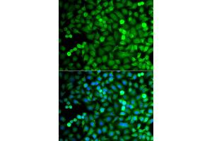 Immunofluorescence analysis of A549 cell using OSGEP antibody. (OSGEP Antikörper)