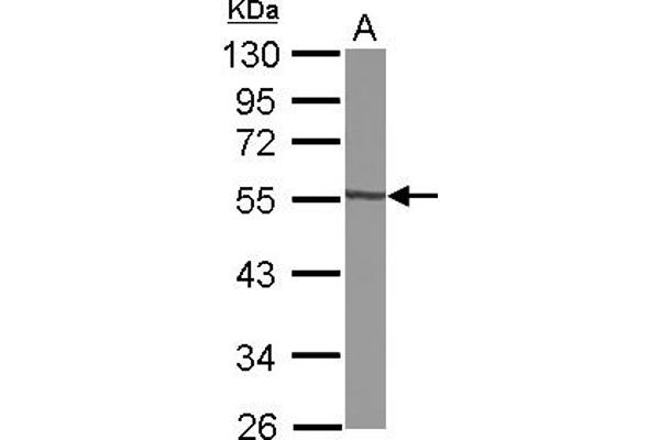 GTDC1 抗体  (AA 1-204)