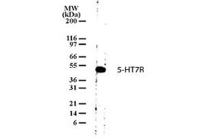 Image no. 1 for anti-5-Hydroxytryptamine (serotonin) Receptor 7 (Adenylate Cyclase-Coupled) (HTR7) (AA 13-28) antibody (ABIN208771) (HTR7 Antikörper  (AA 13-28))