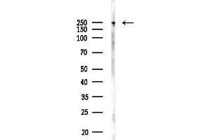 anti-Coiled-Coil Domain Containing 88C (CCDC88C) antibody