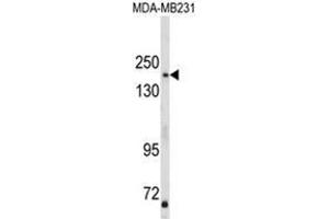 Western blot analysis of TBC1D4 Antibody (N-term) in MDA-MB231 cell line lysates (35ug/lane). (TBC1D4 Antikörper  (N-Term))