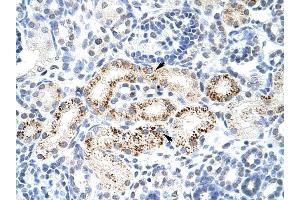PPP1R8 antibody was used for immunohistochemistry at a concentration of 4-8 ug/ml to stain Epithelial cells of renal tubule (arrows) in Human Kidney. (PPP1R8 Antikörper)
