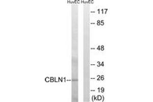 Western blot analysis of extracts from HuvEc cells, using CBLN1 Antibody.