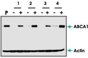 Western blot analysis of ABCA1 induction by cholesterol (+) in human fibroblast cells from different patients (1, 2, 3, 4). (ABCA1 Antikörper  (AA 1800-2260))