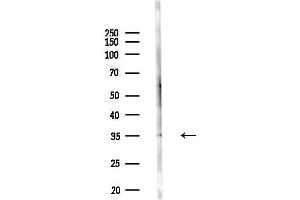 anti-Enolase-Phosphatase 1 (ENOPH1) (C-Term) antibody