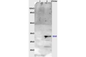 Lane 1: myeloma cell s/p20 lysates Lane 2: mouse brain lysates probed with Anti OTX1 + OTX2 Polyclonal Antibody, Unconjugated (ABIN1387702) at 1:200 in 4 °C. (Otx1 + Otx2 (AA 21-120) Antikörper)