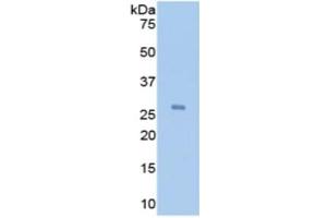 Western Blotting (WB) image for Interleukin 2 Receptor, alpha (IL2RA) ELISA Kit (ABIN6730938)
