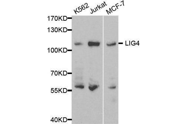 LIG4 Antikörper  (AA 612-911)