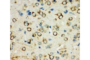 IHC-P: XRCC3 antibody testing of rat brain tissue