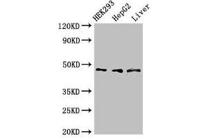 Western Blot Positive WB detected in: HEK293 whole cell lysate, HepG2 whole cell lysate, Rat liver tissue All lanes: ACADSB antibody at 3 μg/mL Secondary Goat polyclonal to rabbit IgG at 1/50000 dilution Predicted band size: 48, 37 kDa Observed band size: 48 kDa (ACADSB Antikörper  (AA 34-253))